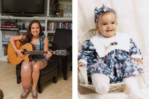 Video: Cô gái có chân phải khổng lồ trở thành hoa hậu - 4