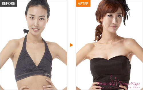 'Phép màu' cho vẻ đẹp toàn diện như mỹ nhân châu Á - 4