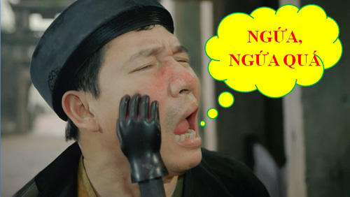 5 mẹo chữa mề đay hiệu quả mà không cần dùng thuốc - 1