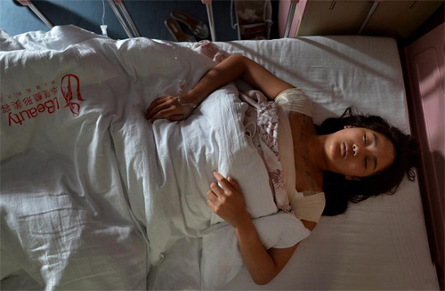 Cận cảnh ca nâng ngực của một người mẫu Trung Quốc - 12