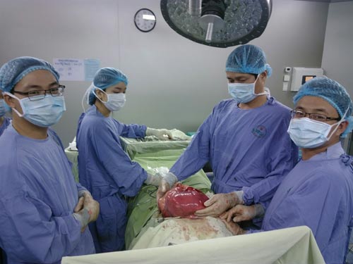 Phẫu thuật thành công khối u khổng lồ nặng 6,5 kg - 1