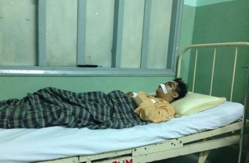 Lê Minh nhóm MTV bị tai nạn giao thông gãy xương đùi - 2