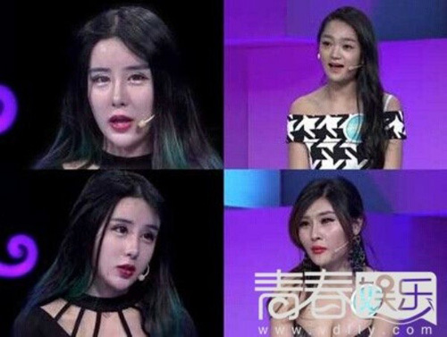 “Thảm họa thẩm mỹ” 15 tuổi:  Tôi thà chết còn hơn xấu - 3