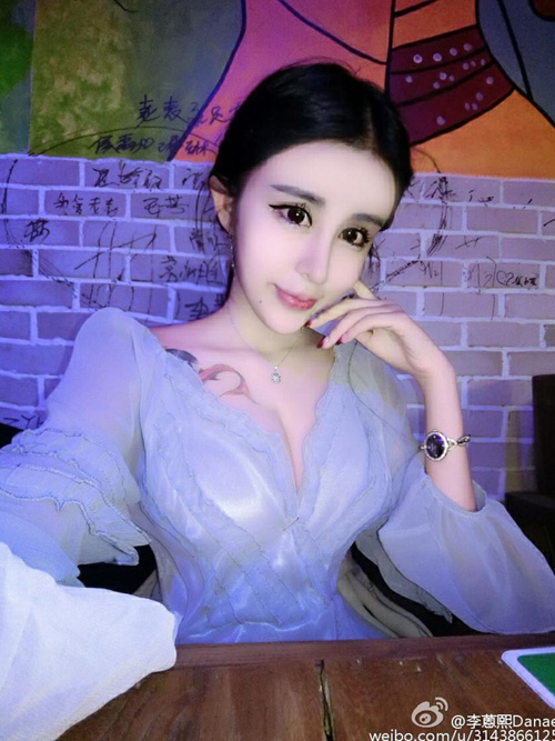 “Thảm họa thẩm mỹ” 15 tuổi:  Tôi thà chết còn hơn xấu - 6