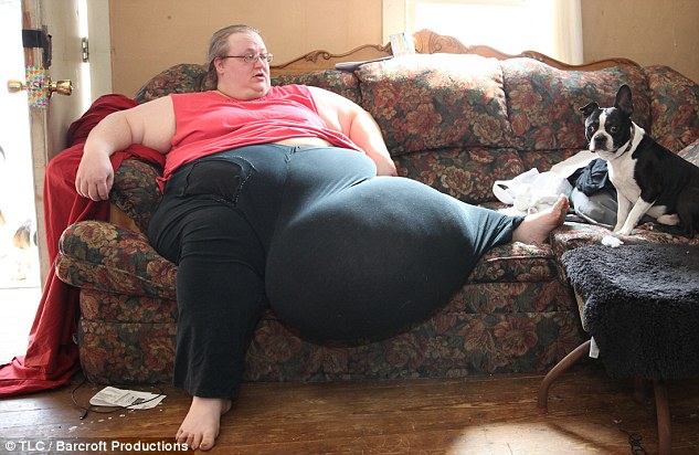 Cắt bỏ thành công khối u nặng 51kg cho một phụ nữ Mỹ - 1