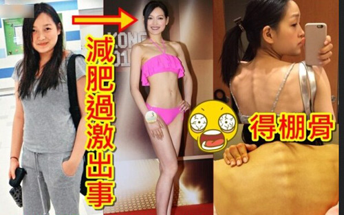 Thí sinh Hoa hậu Hong Kong nhịn ăn, gầy như bộ xương - 1