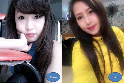 “Rình” bí quyết mũi cao của sao Hàn Quốc - 3