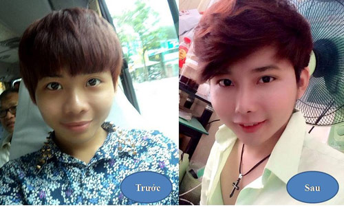 “Rình” bí quyết mũi cao của sao Hàn Quốc - 4