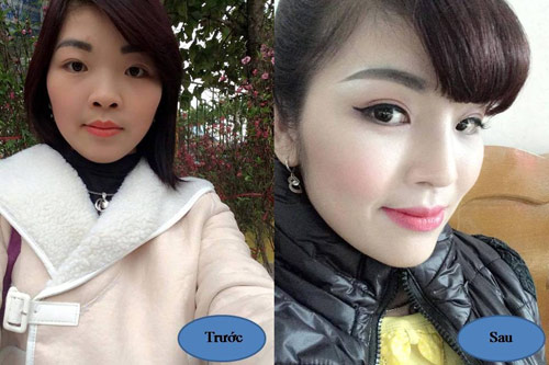 “Rình” bí quyết mũi cao của sao Hàn Quốc - 5