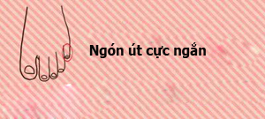 Đoán tính cách của bạn qua đặc điểm bàn chân - 5