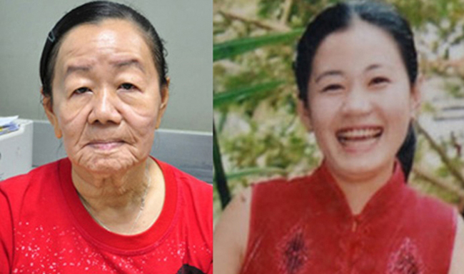 Chị Nguyễn Thị Phượng ở Bến Tre, Việt Nam mắc căn bệnh lão hóa già trước tuổi đã đột ngột qua đời ở tuổi 30 sau ba năm chống trọi với bệnh tật.