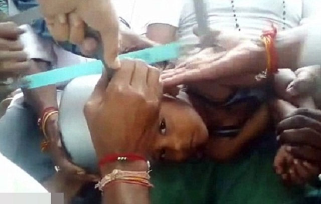 Cưa đôi nồi áp suất giải cứu cậu bé Ấn Độ bị kẹt đầu - 1