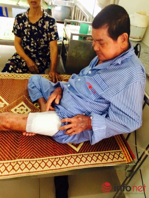 Một tuần bị nhọt, nhập viện bị cắt chân ngay lập tức - 2