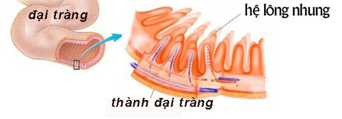 Xem ngay cách điều trị viêm đại tràng đơn giản mà hiệu quả - 2