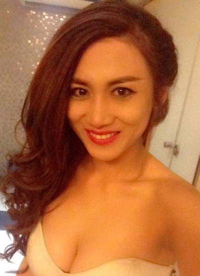 Phụ nữ 30+ và nỗi buồn mắt sụp mí - 1