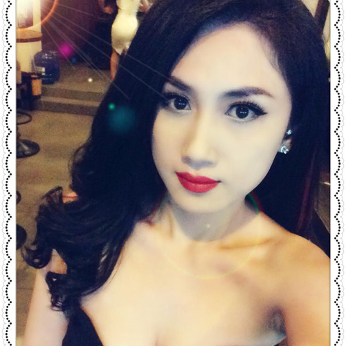 Phụ nữ 30+ và nỗi buồn mắt sụp mí - 2