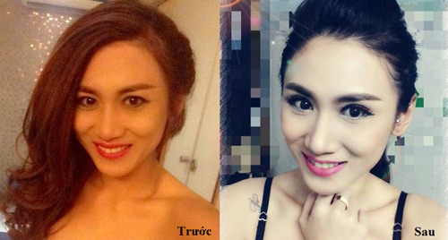 Phụ nữ 30+ và nỗi buồn mắt sụp mí - 4