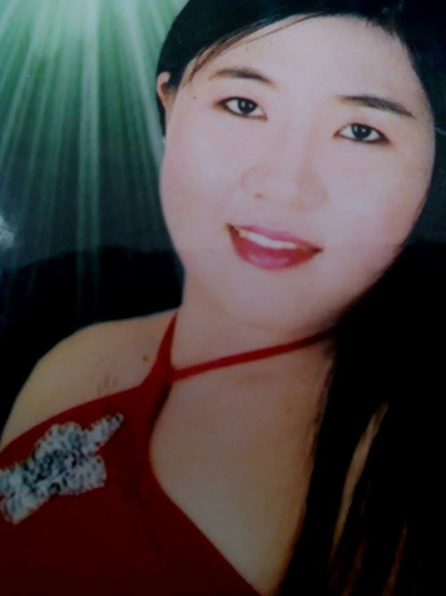 Cô gái 29 tuổi hóa bà lão 70 là nạn nhân của corticoid - 2