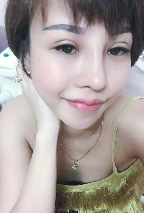 Chị em thi nhau bơm, rạch để có môi trái tim quyến rũ - 3