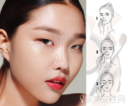 Xử lý mũi gồ ghề, tẹt dí không cần phẫu thuật - 7