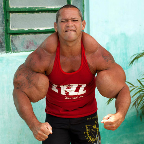 Ngực, tay biến dạng kỳ dị vì tiêm dầu, cồn vào người - 4