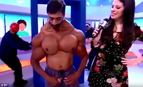 Ngực, tay biến dạng kỳ dị vì tiêm dầu, cồn vào người - 1