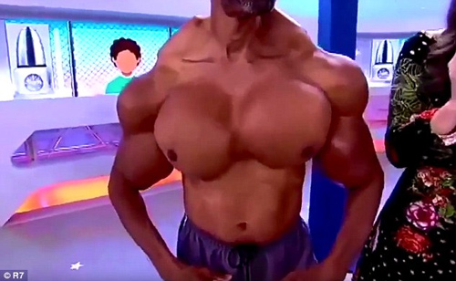 Ngực, tay biến dạng kỳ dị vì tiêm dầu, cồn vào người - 2