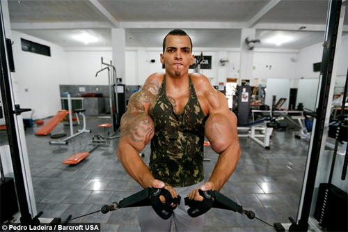 Ngực, tay biến dạng kỳ dị vì tiêm dầu, cồn vào người - 8