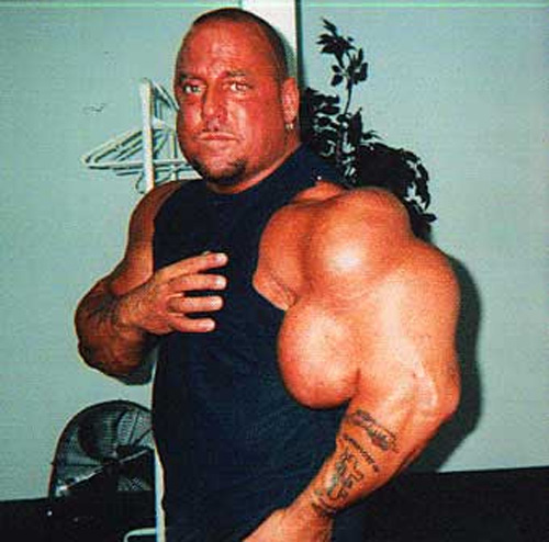 Ngực, tay biến dạng kỳ dị vì tiêm dầu, cồn vào người - 14