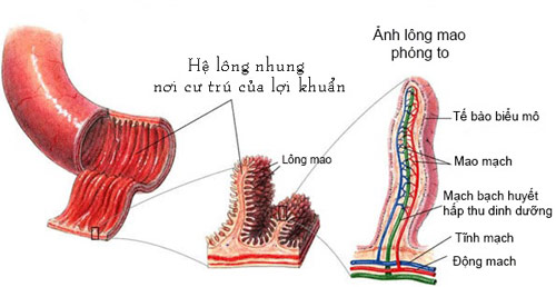 Bất ngờ với cách chữa viêm đại tràng đơn giản mà hiệu quả - 2