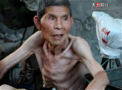Nhịn đói để sống trường thọ và cái kết đau đớn cho cụ ông 60 tuổi - 1