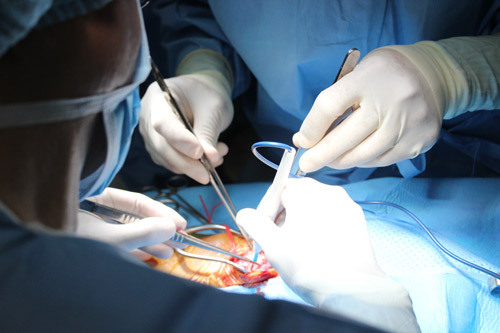 U cuộn cảnh: Hơn 1 triệu người mới có một ca - 3