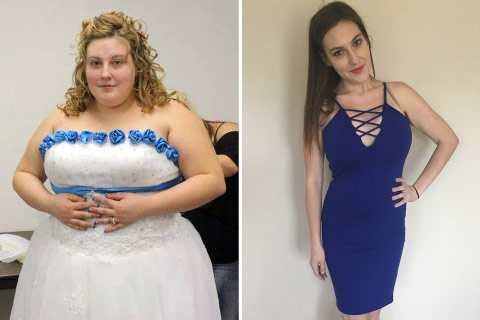 Màn giảm cân "ngoạn mục" của cô gái trẻ từng 144 kg - 1