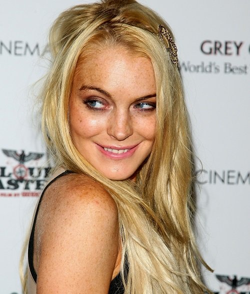 6 sao Hollywood suýt hỏng môi vì tiêm chất làm đầy - 3