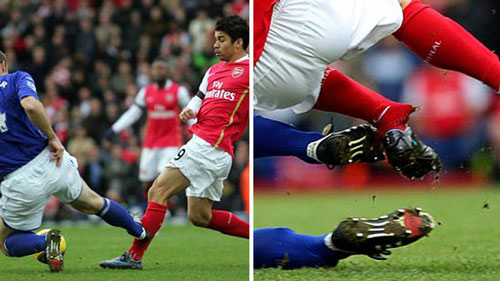 Chấn thương ghê rợn: Demba Ba “nhập hội” Ronaldo - 3