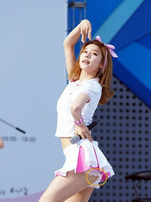 Sự thật những vết thâm trên đùi của sao nữ Hàn - 2