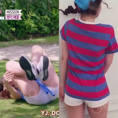 Sự thật những vết thâm trên đùi của sao nữ Hàn - 3