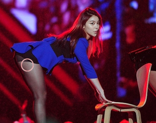 Sự thật những vết thâm trên đùi của sao nữ Hàn - 4