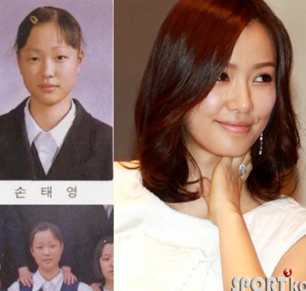 Các cặp sao yêu nhau cùng bị tố "dao kéo" khắp mặt - 10