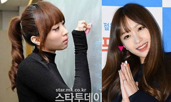 Các cặp sao yêu nhau cùng bị tố "dao kéo" khắp mặt - 2