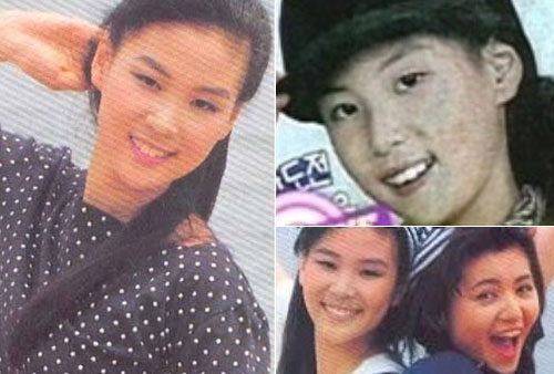 Các cặp sao yêu nhau cùng bị tố "dao kéo" khắp mặt - 12