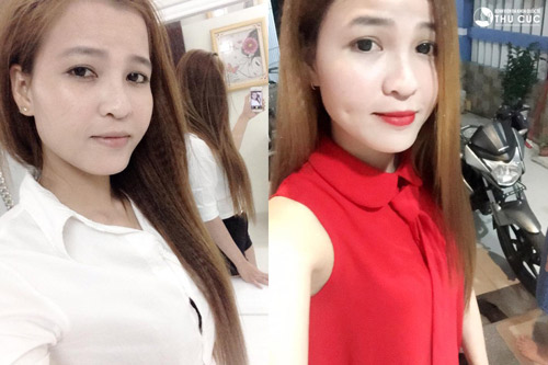 Nụ cười "xinh khó cưỡng” của cô lễ tân quán bar sau thẩm mỹ - 1
