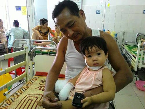 Bố mẹ ngủ trưa, con 2 tuổi đút tay vào ổ điện - 1