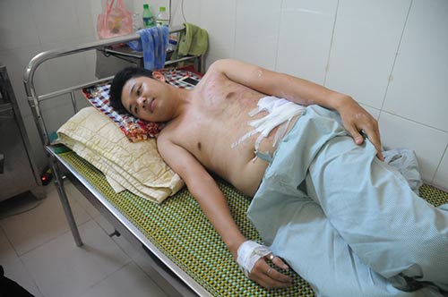 Bố mẹ ngủ trưa, con 2 tuổi đút tay vào ổ điện - 2