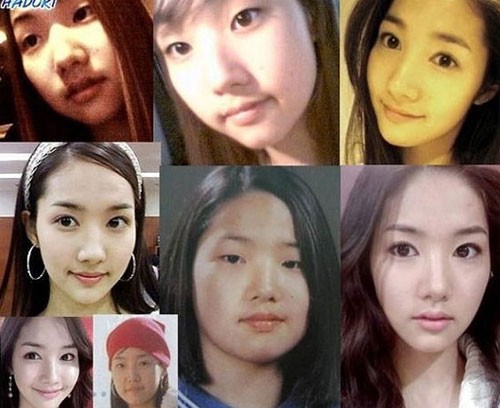 Bồ cũ Lee Min Ho xinh đẹp rạng ngời sau 5 lần dao kéo - 7