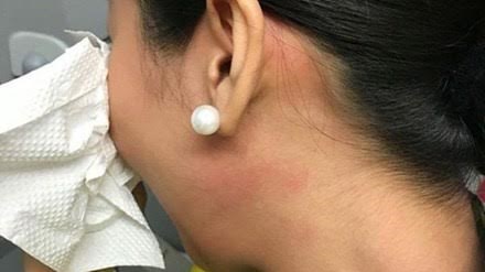 Tiếp viên bị chấn động tâm lý sau cú ra đòn của khách VIP - 1