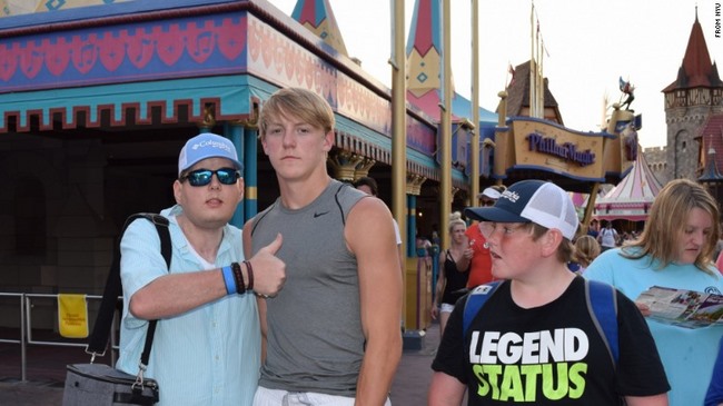 Người đầu tiên được ghép mặt người khác giờ ra sao? - 4