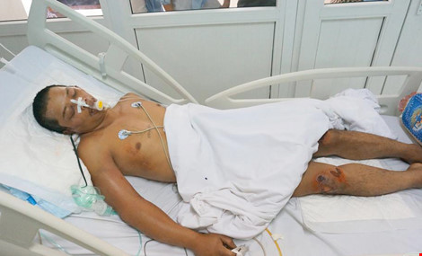 Tìm tông tích nam nạn nhân có chữ “không hận” trên ngực - 2