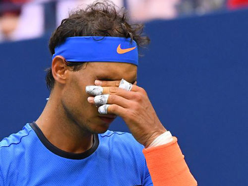 Thua sốc, Nadal không biết lý do từ đâu - 1