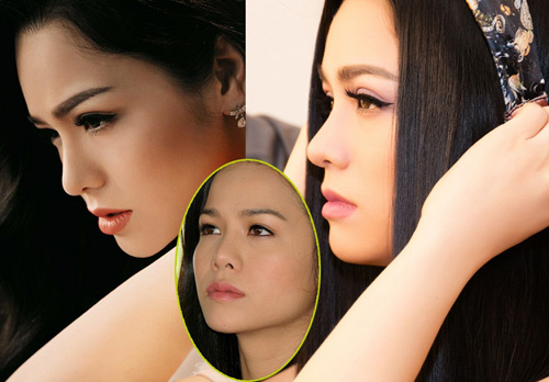 Nhật Kim Anh “lên đời” nhan sắc nhờ bác sĩ Hiệp Lợi - 5